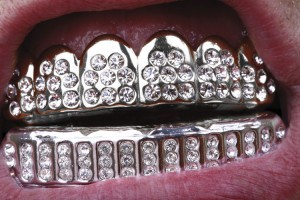 grillz1-300x200.jpg